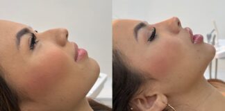 Cómo Instagram y TikTok están cambiando la percepción de la belleza y la autoestima